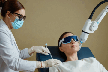 The Ultimate Guide to Laser Treatment for Pigmentation