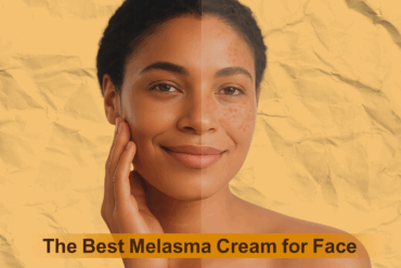 Discover the Best Melasma Cream for Face That Really Works