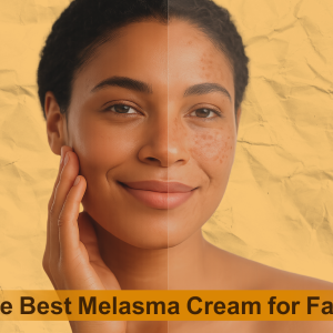 Discover the Best Melasma Cream for Face That Really Works